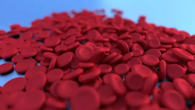Tongue Coating Analysis for Parkinson’s Disease Detection